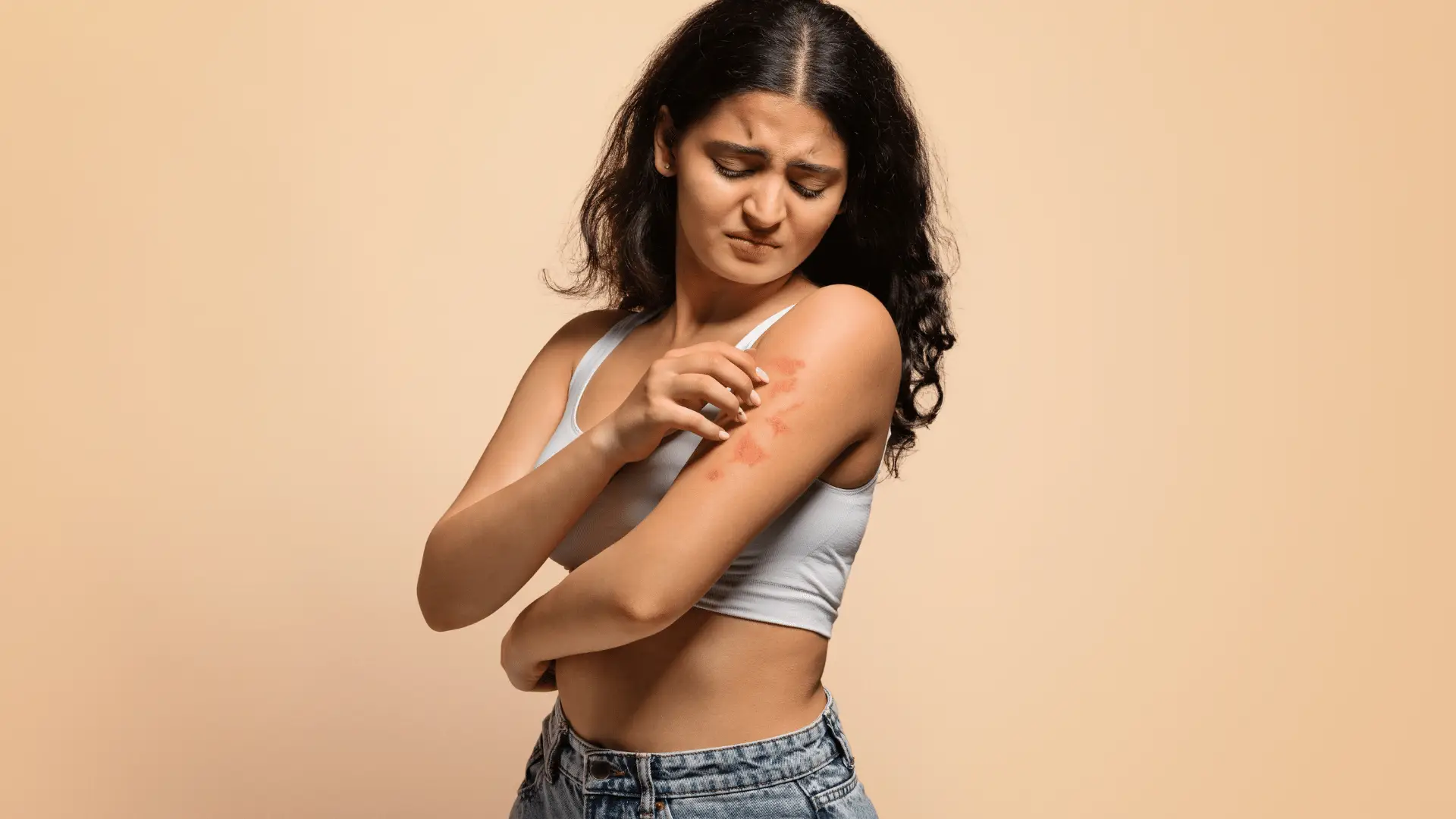 Psoriasis, a dermatology condition studied at Stryde Research sites